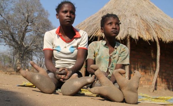 zimbabwe - vadona people